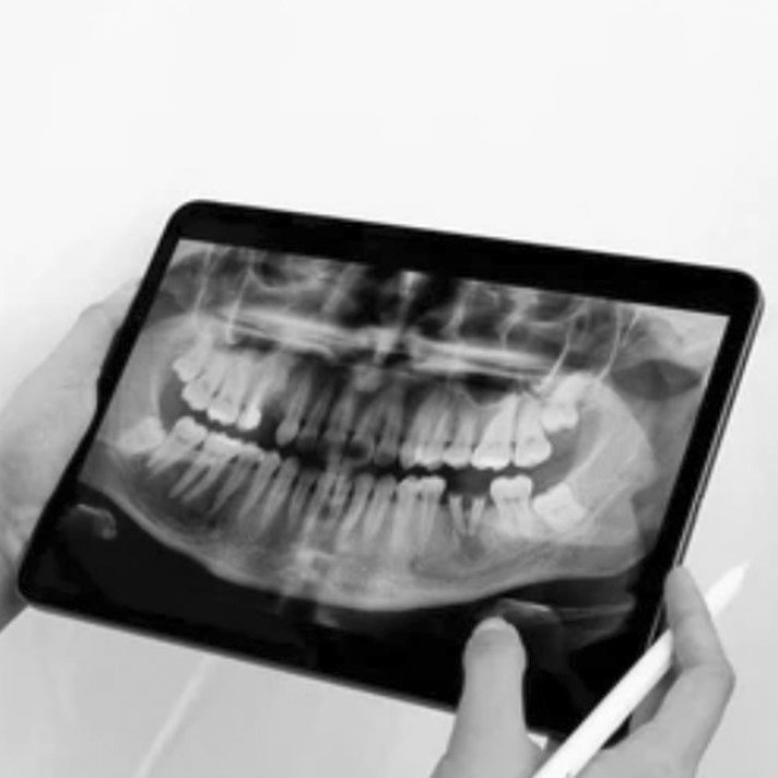 12 galeria_laboratorio_dental_methalab_712x712_gris